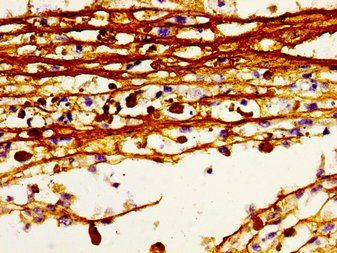 HDC Antibody