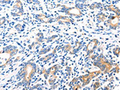 HDC Antibody