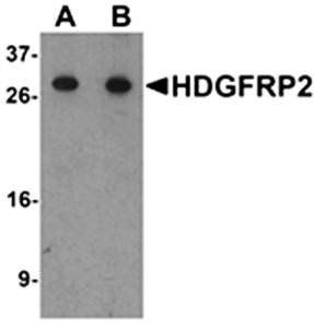 HDGFRP2 Antibody