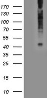 HDHD1A (PUDP) antibody