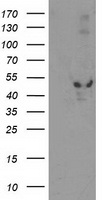 HDHD1A (PUDP) antibody