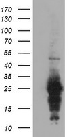 HDHD2 Antibody