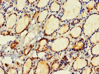 HDHD2 Antibody
