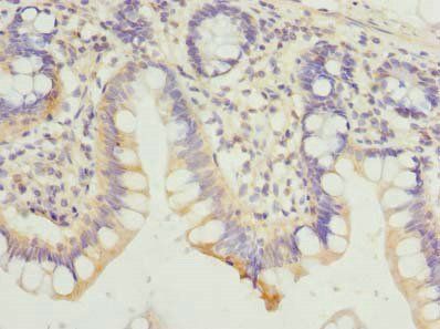 HDHD3 Antibody