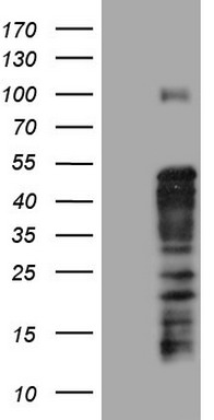 HE4 (WFDC2) antibody