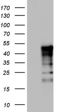HE4 (WFDC2) antibody