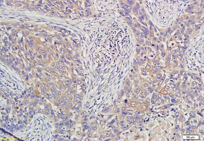 HE4 Rabbit Polyclonal Antibody