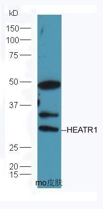 HEATR1 antibody