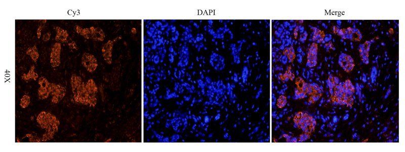 HECTD1 antibody