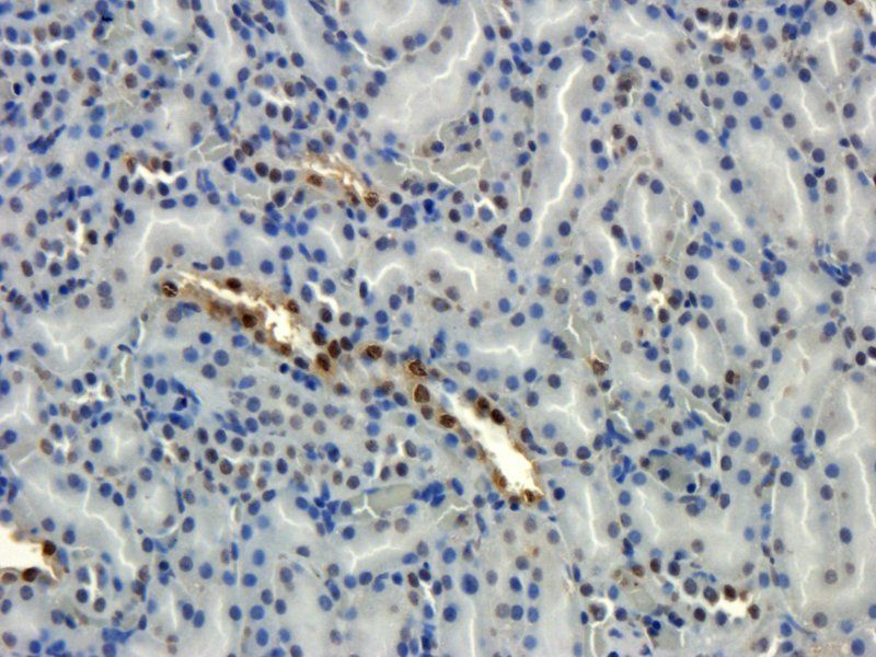 HECTD1 Rabbit Polyclonal Antibody