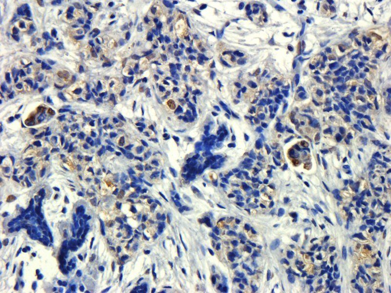 HECTD1 Rabbit Polyclonal Antibody