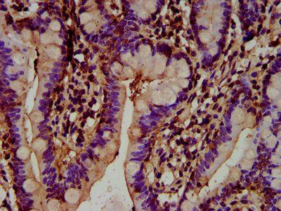 HECTD2 Antibody