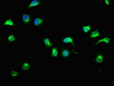 HECTD3 Antibody