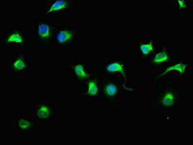 HECTD3 antibody