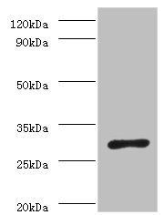 Helicobacter pylori Urease subunit alpha antibody