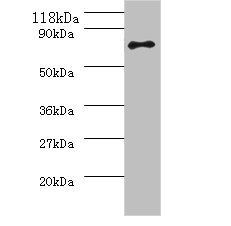 Helicobacter pylori Urease subunit beta antibody