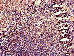 HELLS Antibody