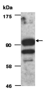 HELLS (C) Antibody, Rabbit Polyclonal