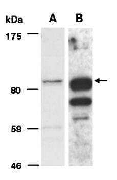 HELLS (vPairTM) Antibodies