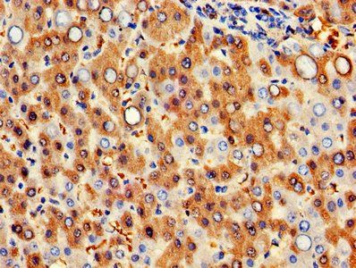 HBB Antibody