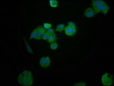 HEPACAM Antibody