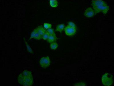 HEPACAM antibody