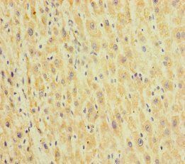 HEPACAM2 Antibody