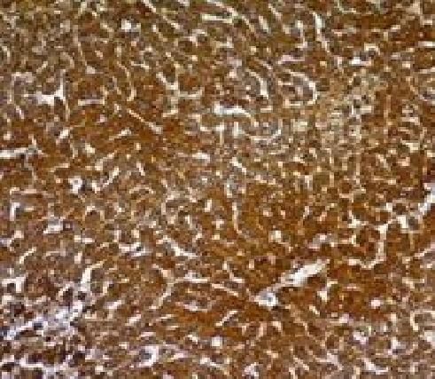 Hepatocyte Specific Antigen (Hepatocellular Marker) Antibody