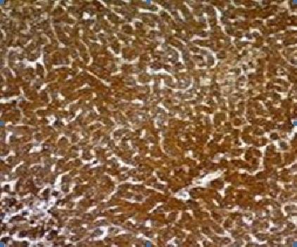 Hepatocyte Specific Antigen (Hepatocellular Marker) Antibody