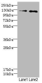 HEPH antibody