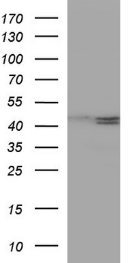 Her2 (ERBB2) antibody