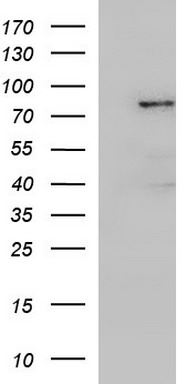 Her2 (ERBB2) antibody