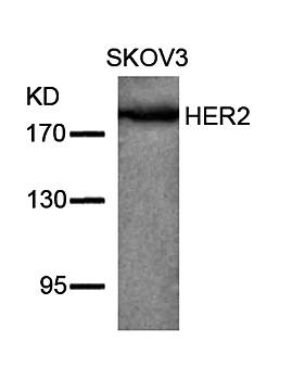 HER2 (Ab-877) Antibody