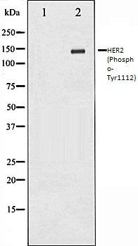 HER2 (Phospho-Tyr1112) antibody