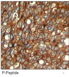 HER2 (Phospho-Tyr1248) Antibody