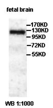 HERC4 Rabbit Polyclonal Antibody