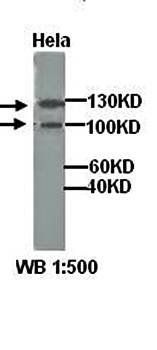 KCNH2 Rabbit Polyclonal Antibody