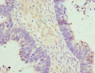 HERPUD1 Antibody