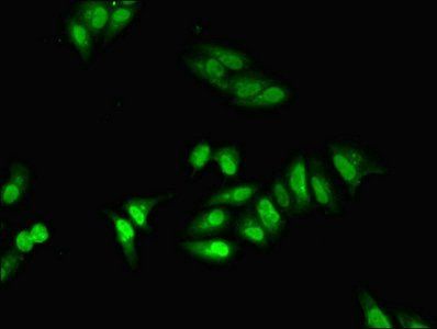 Heterogeneous nuclear ribonucleoprotein A1 antibody