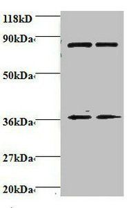 Heterogeneous nuclear ribonucleoprotein H antibody