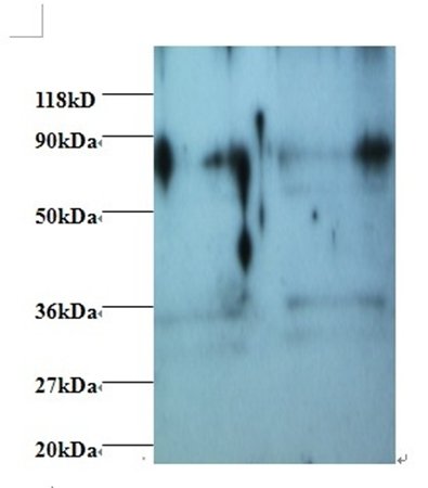 Heterogeneous nuclear ribonucleoprotein H antibody (Biotin)