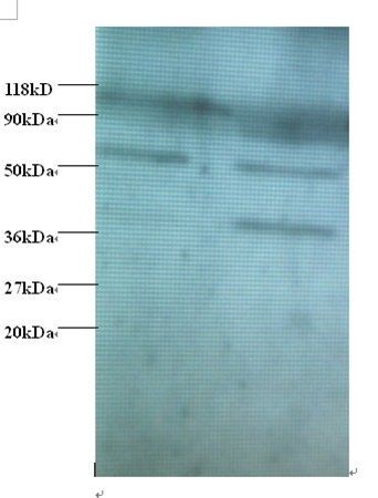 Heterogeneous nuclear ribonucleoprotein Q antibody