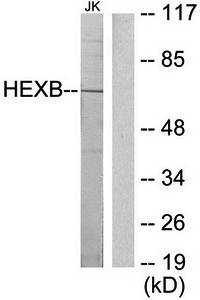 HEXB antibody