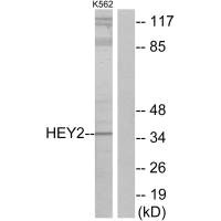 HEY2 antibody