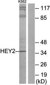 HEY2 antibody