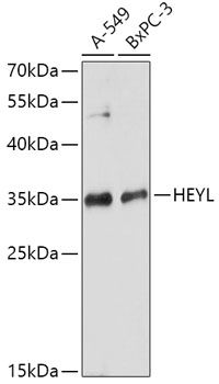 HEYL antibody