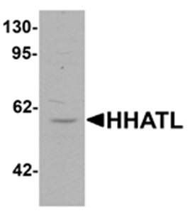 HHATL Antibody