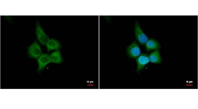 HHIP antibody [N3C2], Internal