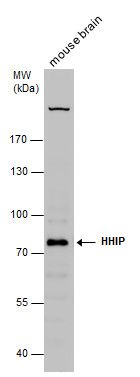 HHIP Rabbit Polyclonal Antibody