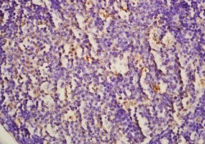 HHIP Rabbit Polyclonal Antibody